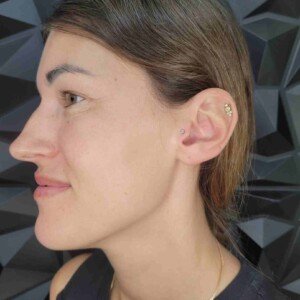 Ear tragus single ring piercing with surgical steel stud at Lethal Ink Tattoo Pattaya. Ear tragus single ring piercing surgical steel stud at Lethal Ink Tattoo Pattaya (2026)